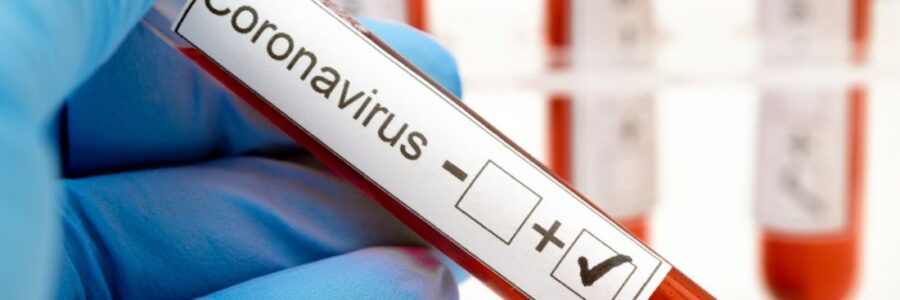 Números que alarman: 335 nuevos casos y tres muertes por coronavirus en Salta