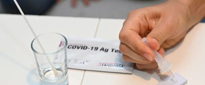 La ANMAT aprobó cuatro autotest para detectar el coronavirus