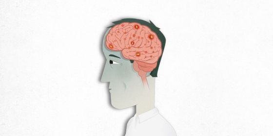 Se realizará una jornada sobre la epilepsia en el hospital Materno Infantil